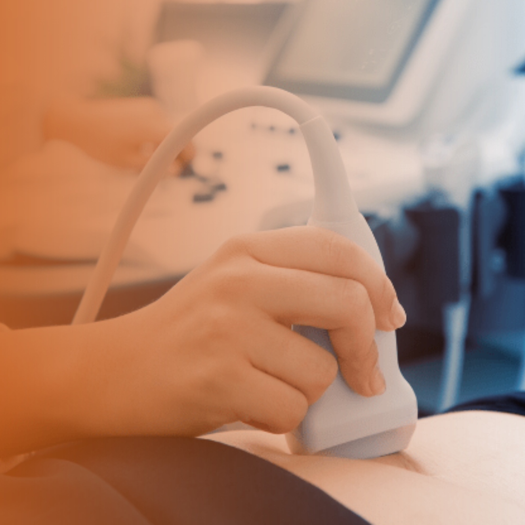 Ultrassonografia Point of Care (POCUS)